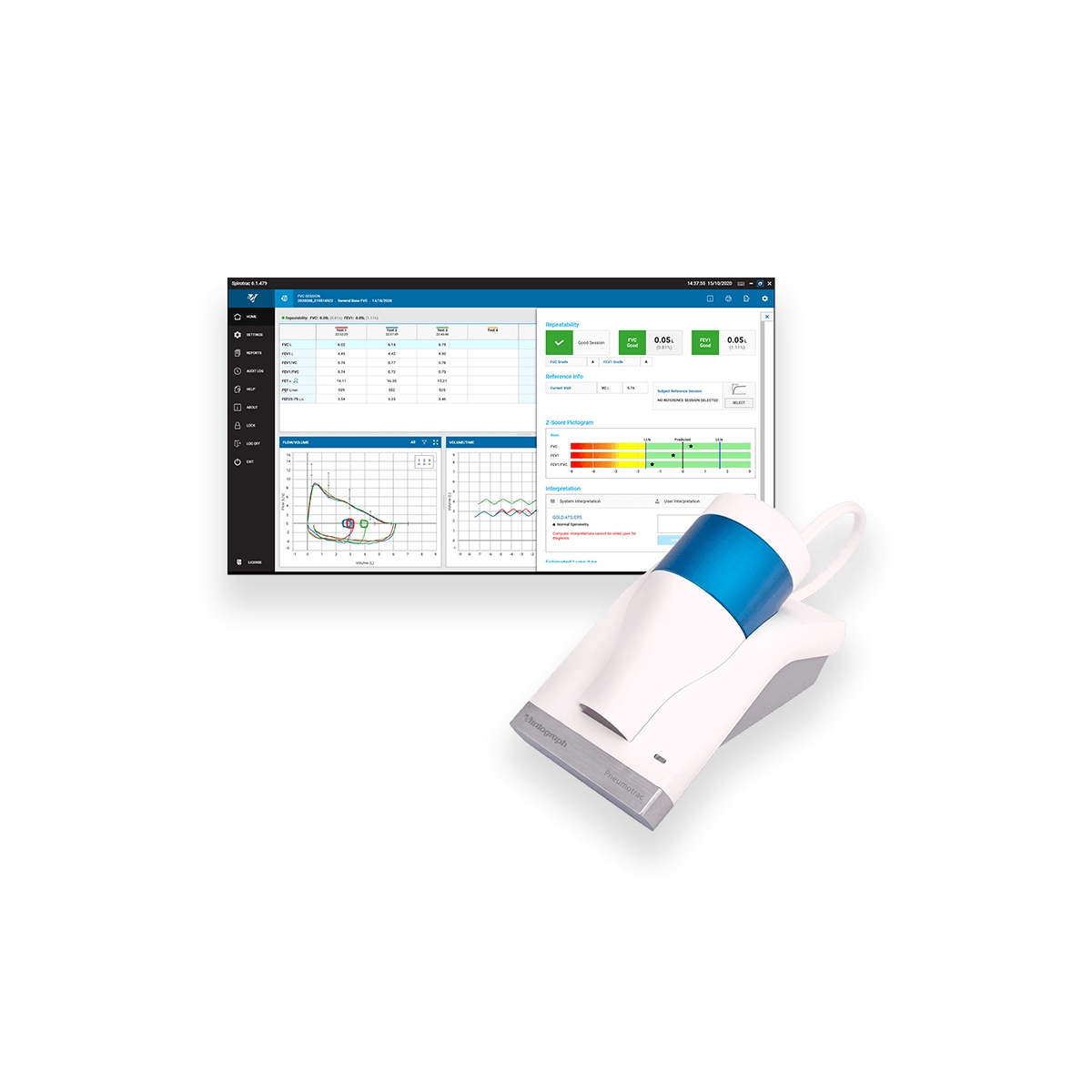 Spiromètre de bureau PNEUMOTRAC 6800 avec logiciel