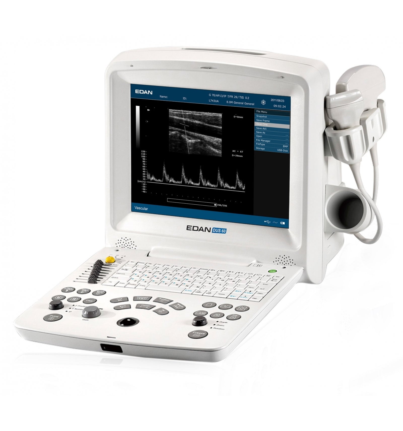 Echographe portable DUS60 EDAN - Unité centrale
