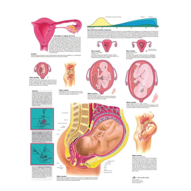 Planche anatomique - La grossesse