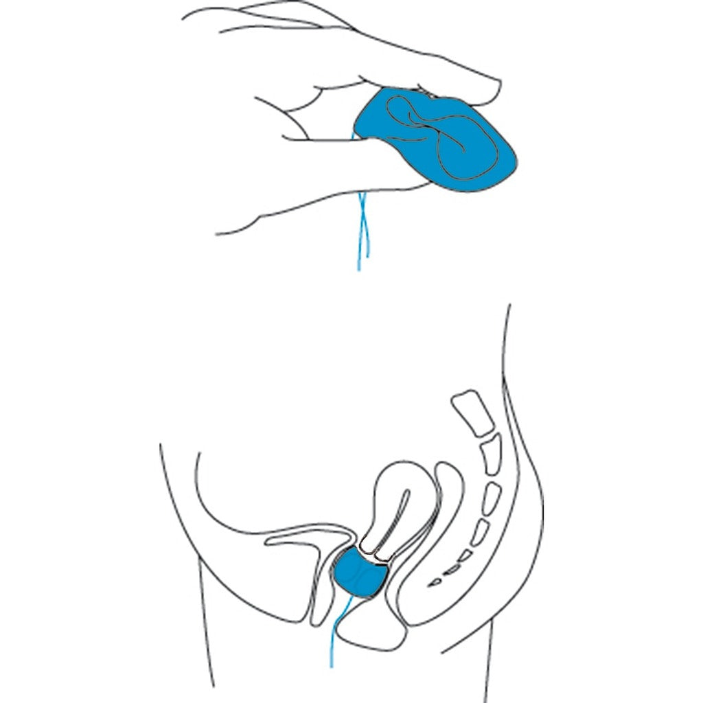 Pessaire silicone Gyn&Cube - GYNEAS