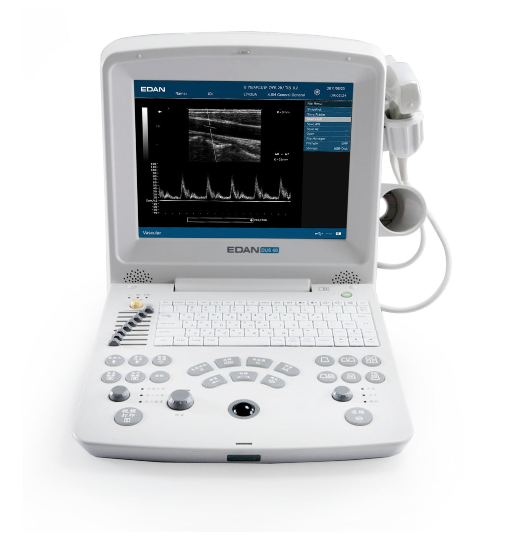 Echographe portable DUS60 EDAN - Unité centrale